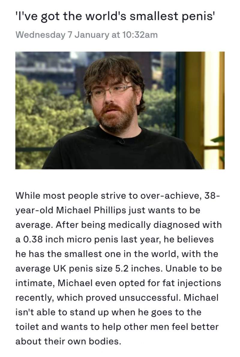 세상에서 가장 작은 성기를 가졌다는 남자