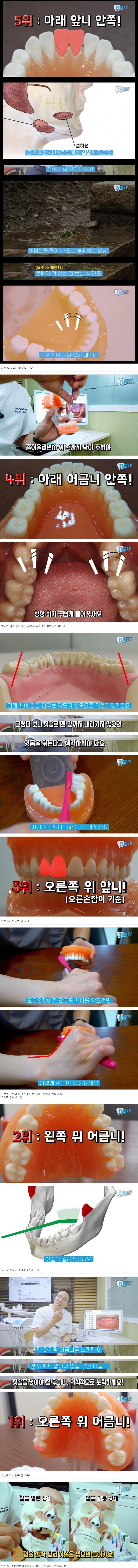 양치질 할 때 특히 신경 써야 하는 부위