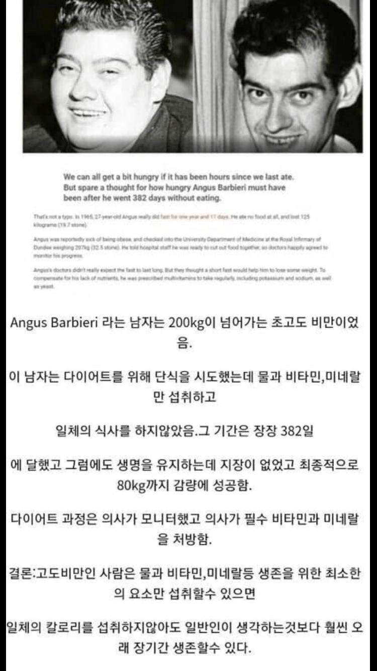 초고도비만은 최대 얼마나 굶을 수 있을까