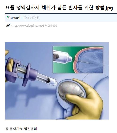 요즘 정액검사시 채취가 힘든 환자를 위한 방법