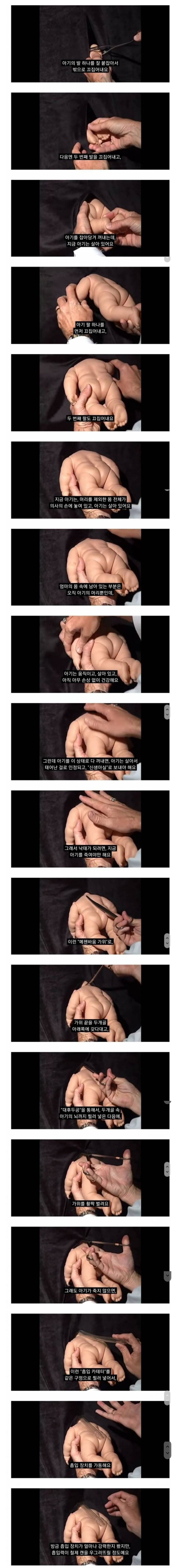 36주 낙태하고 살인죄 피하는법 feat. 여성시대