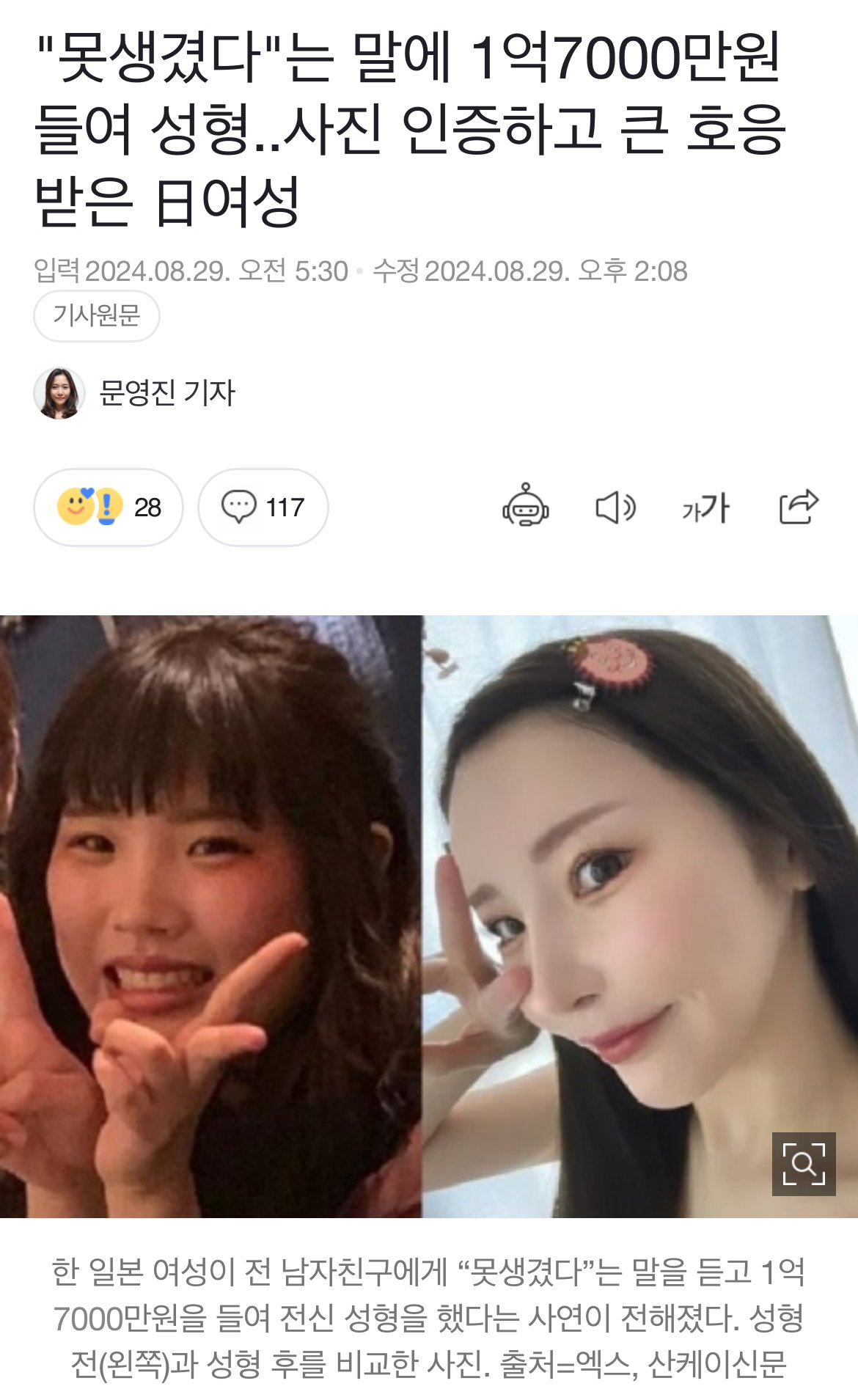 “못생겼다” 전남친말에 1억7천들여 성형한 여성