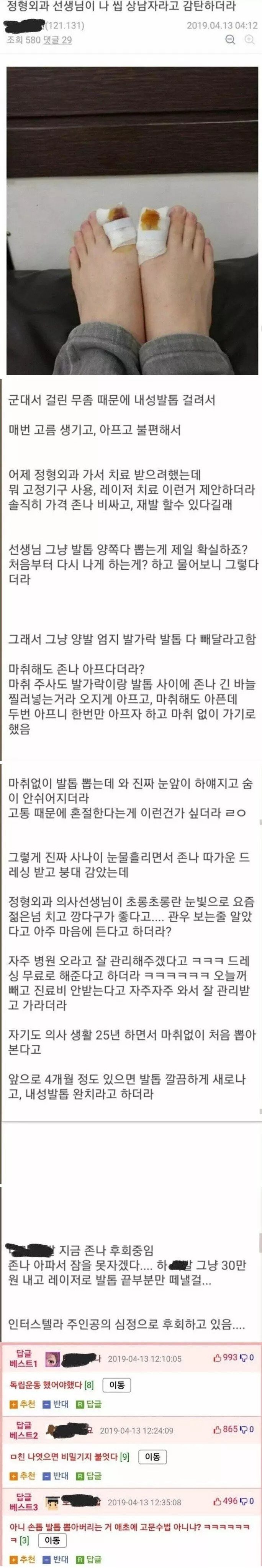 약혐) 내성발톱 쉽고 간단하게