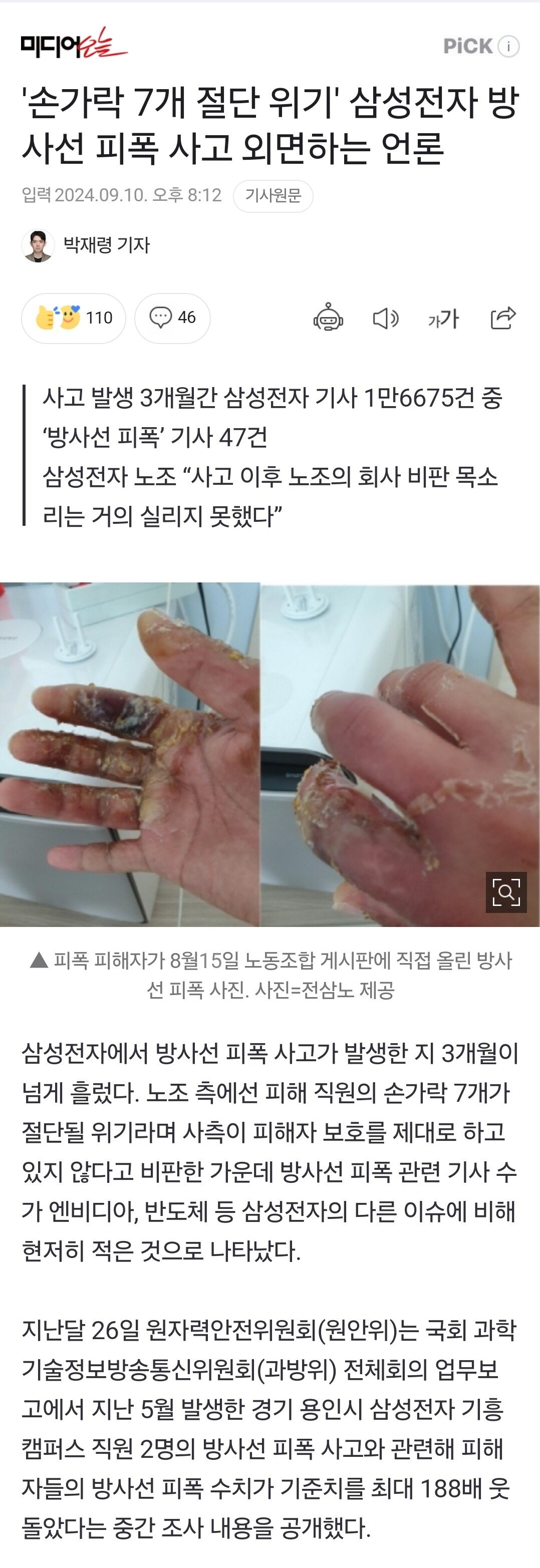 '손가락 7개 절단 위기' 삼성전자 방사선 피폭 사고 외면하는 언론
