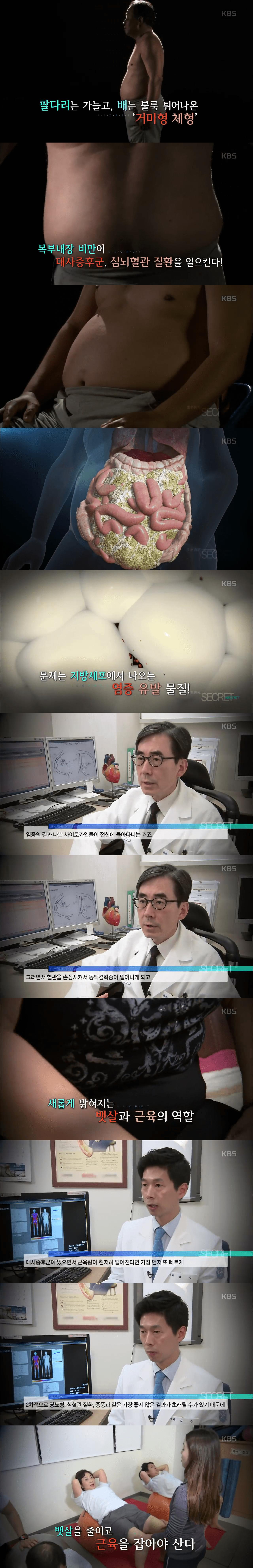 우리나라에 굉장히 많은 체형