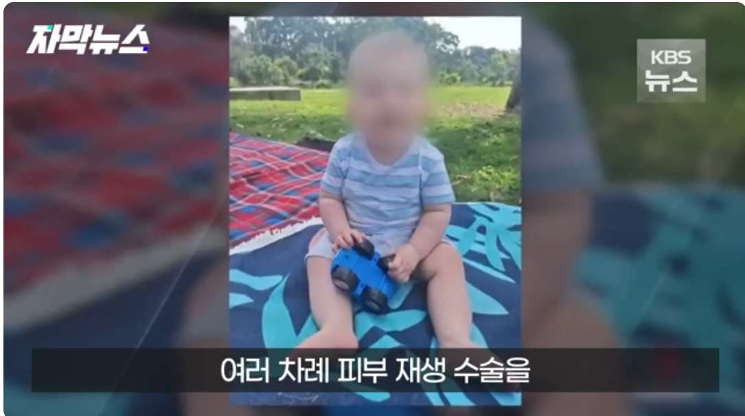 얼마전 호주에서 일어난 아기 커피 테러사건 근황