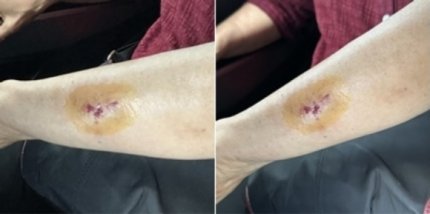 “버스서 팔 닿았다고… 20대女, 3세 아이에 주먹질하고 할머니 깨물어