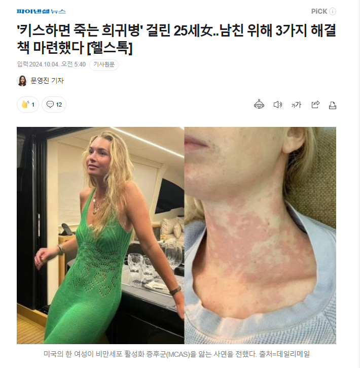 키스하면 죽는 희귀병' 걸린 25세女..남친 위해 3가지 해결책