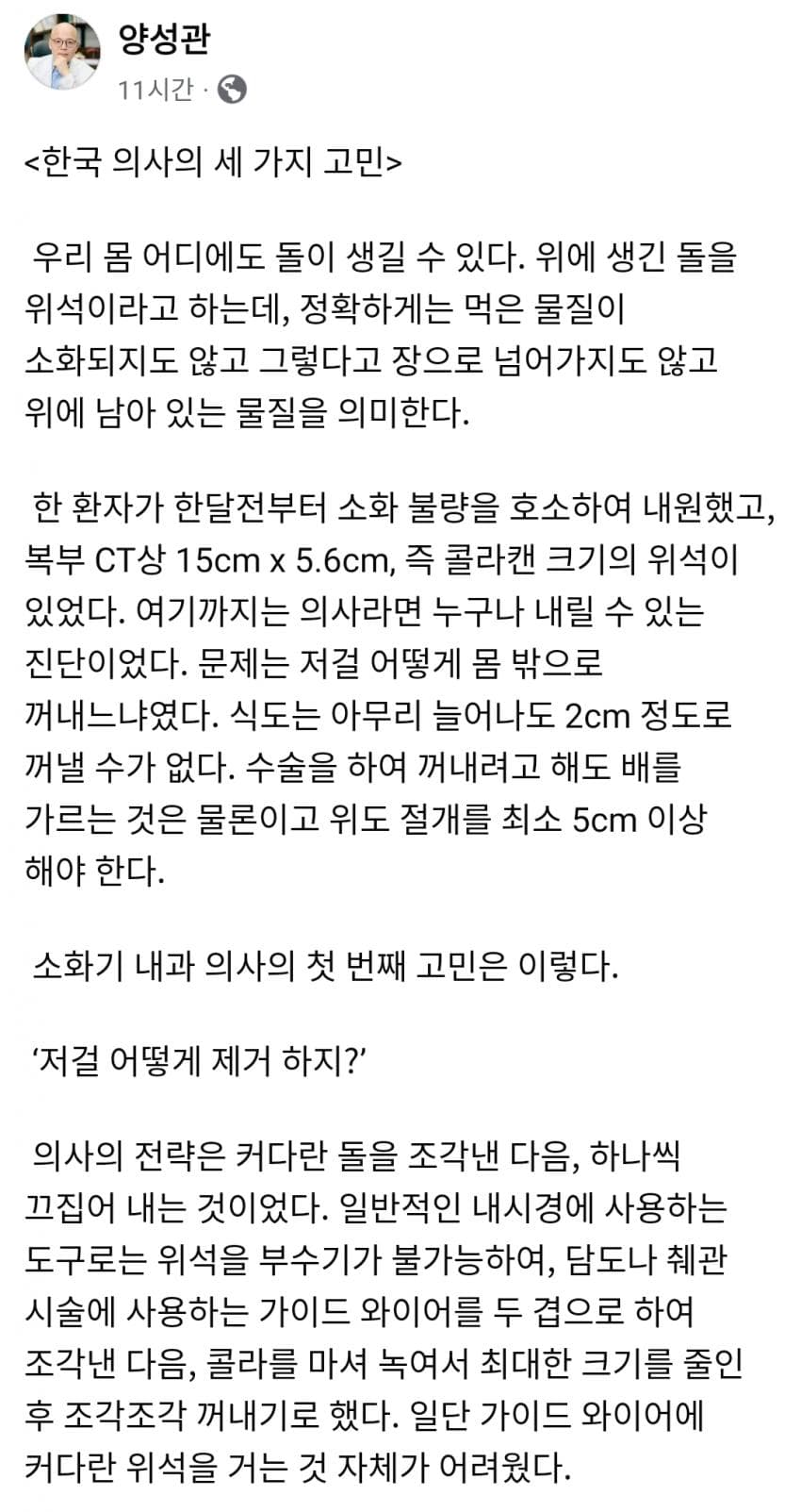 혐)한 의사의 위석 제거 썰