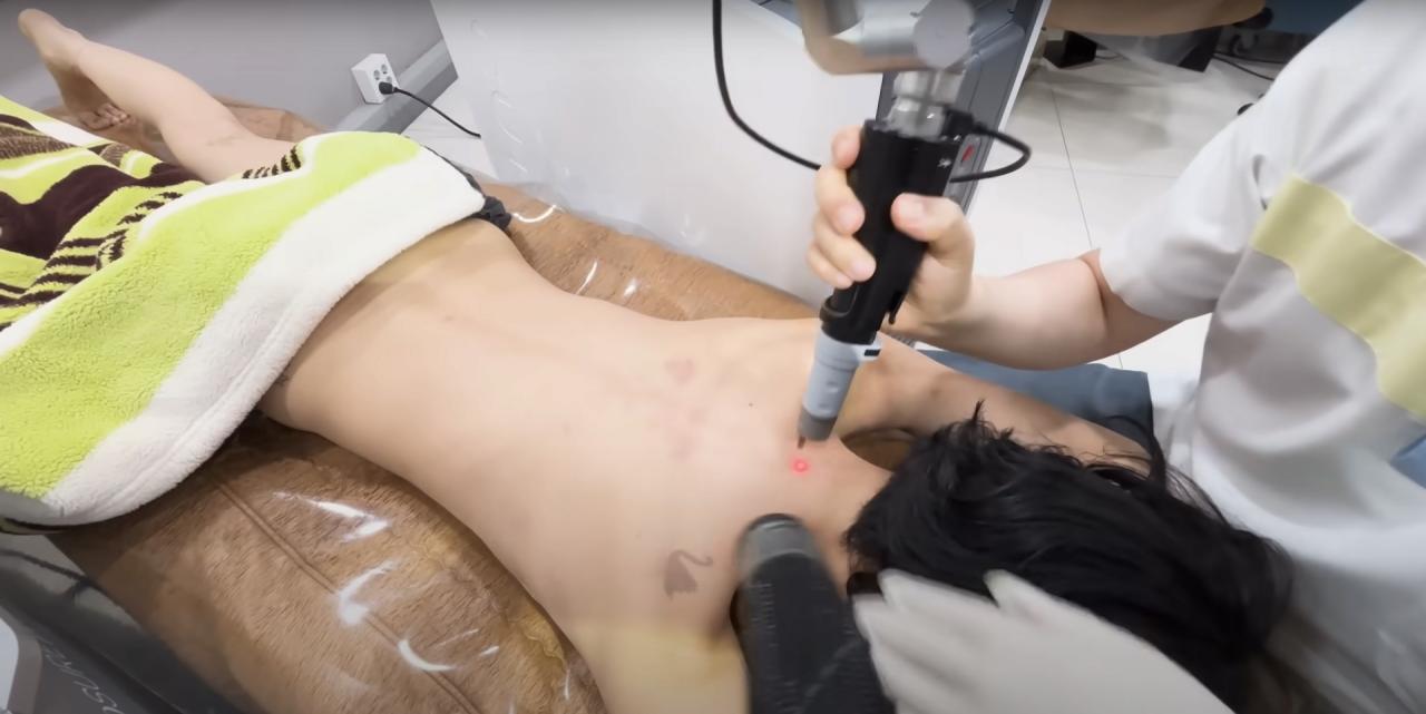 ㅇㅎ) 타투 지우는 나나(에프터스쿨)