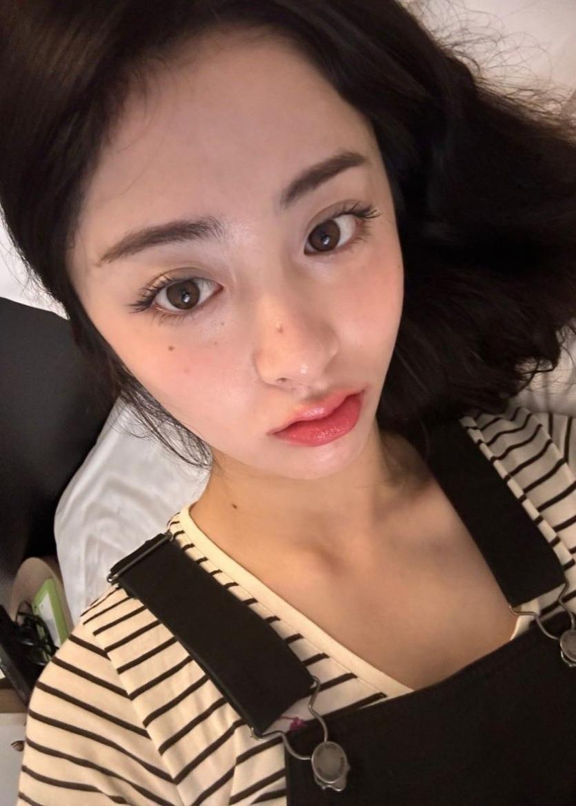 르세라핌 허윤진