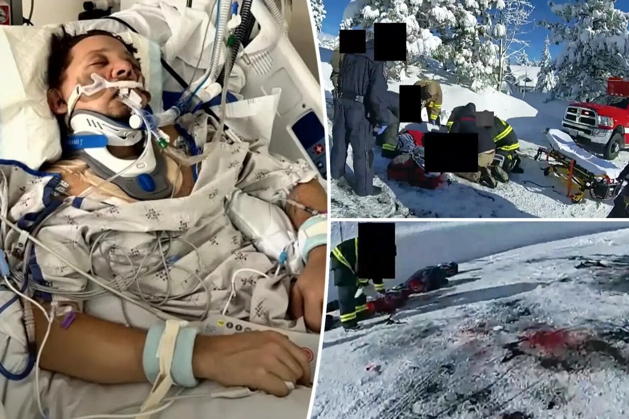 죽다 살아난 호크아이 성님 근황