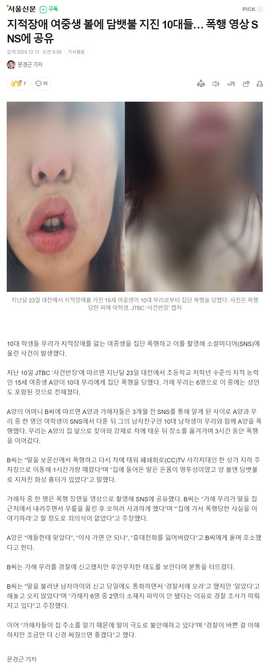 지적장애 여중생 볼에 담뱃불 지진 10대들