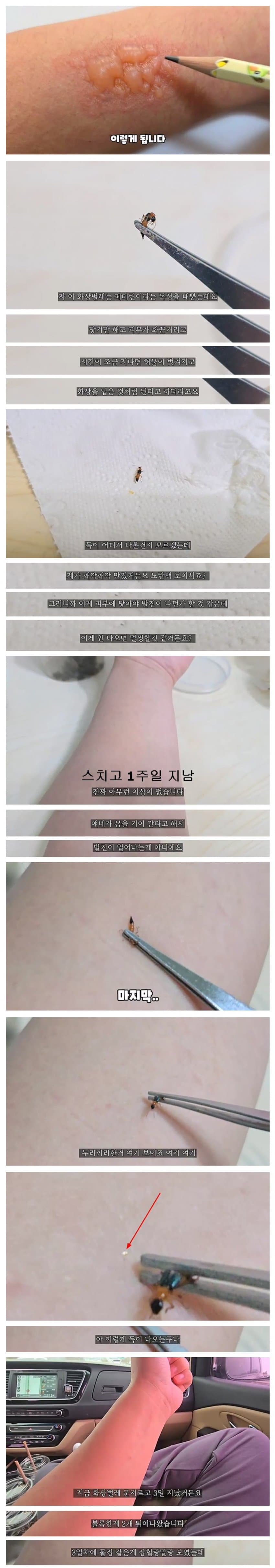 약혐) 스치기만해도 화상을 입는다는 벌레로 실험한 유튜버