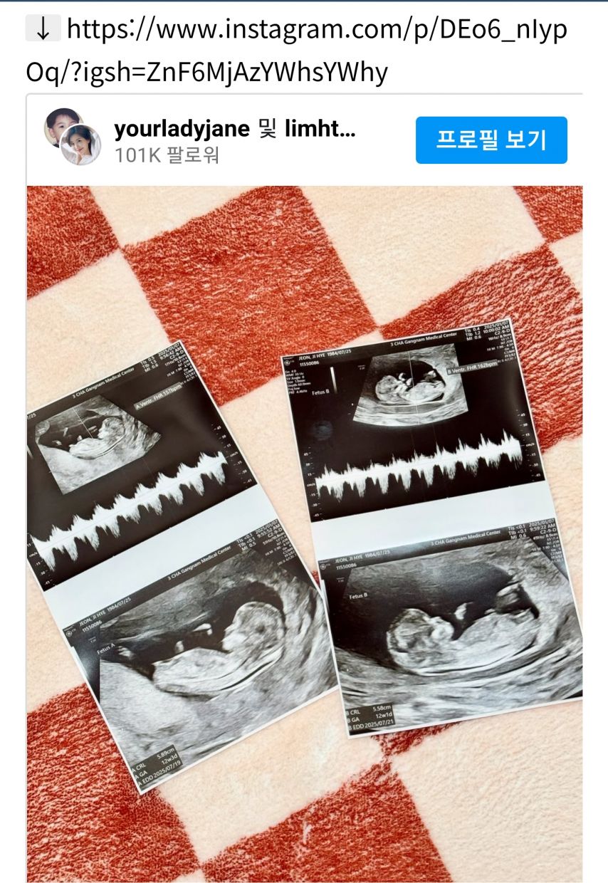 가수 레이디제인 쌍둥이 임신 발표 [정보글]