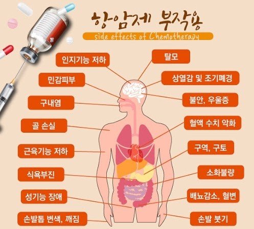 항암치료받은지 6년조금넘엇는데 지금까지도있는 후유증