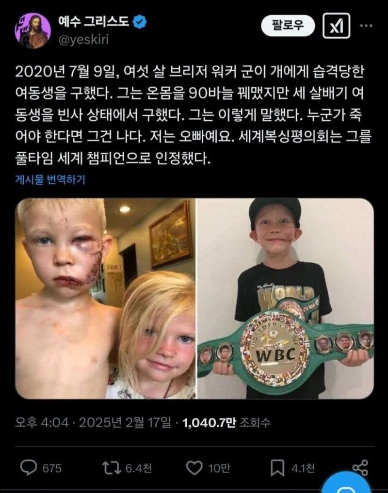 여동생을 개로부터 구했다는 오빠 근황 ㅎㄷㄷㄷㄷㄷ