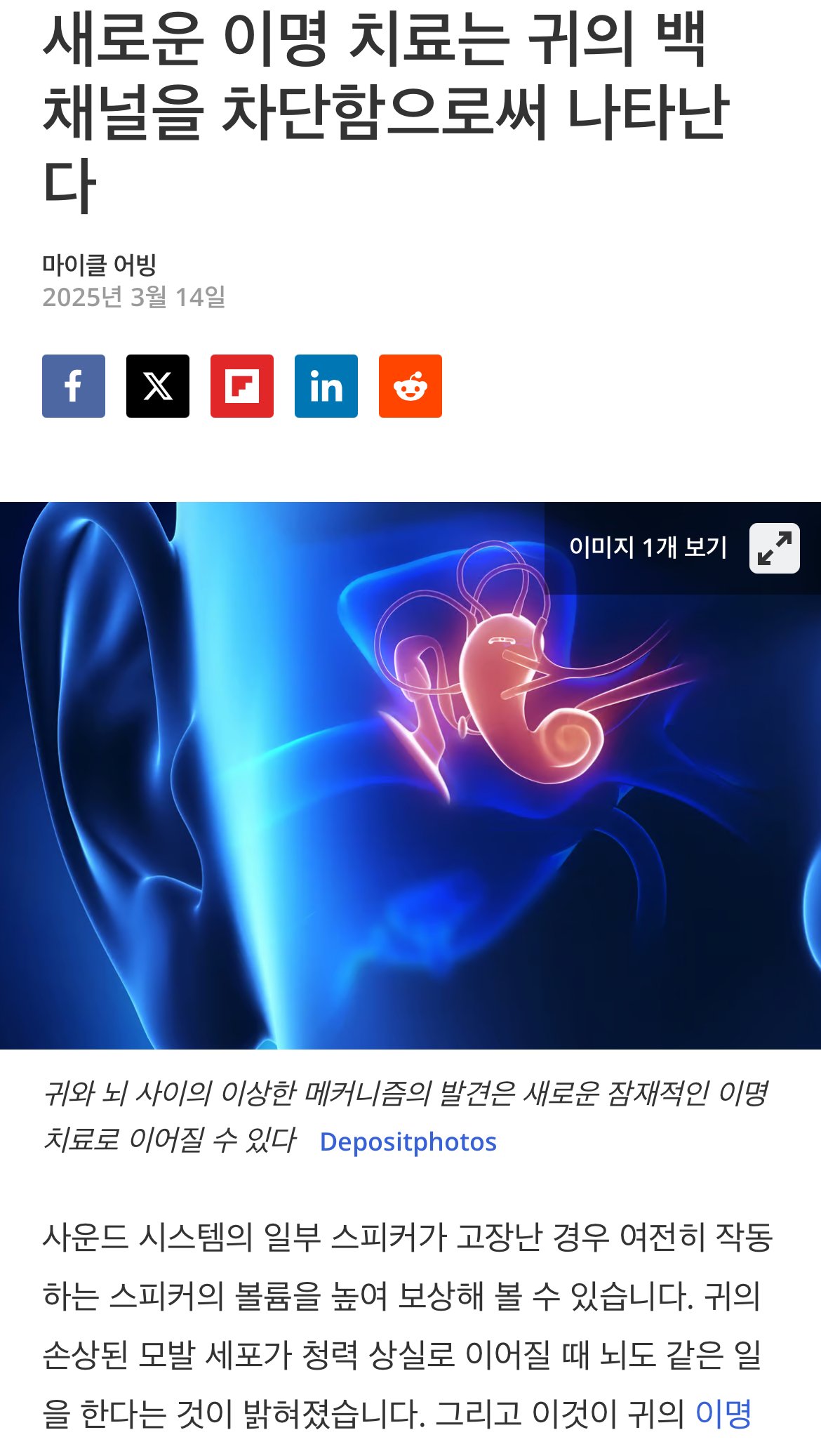 현재 찾아냈다는 이명에 대한 새로운 원인 근황 ㅎㄷㄷㄷ