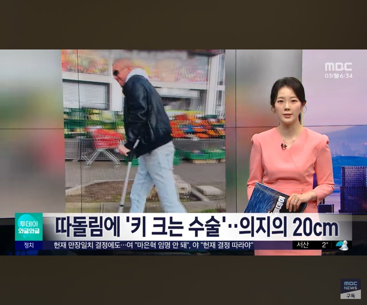 동양인들 이해 못하는 수술