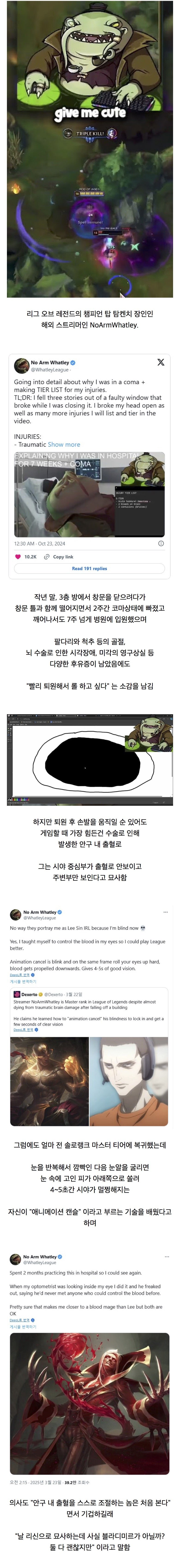 뇌 수술 후 반쯤 안보이는 스트리머가 롤 마스터 복귀 ㅎㄷㄷㄷ