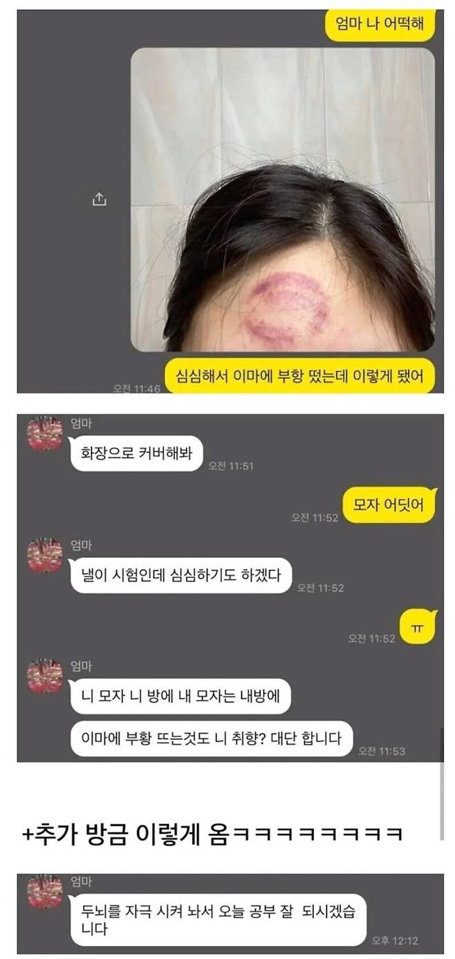 심심해서 이마에 부항 뜬 여자