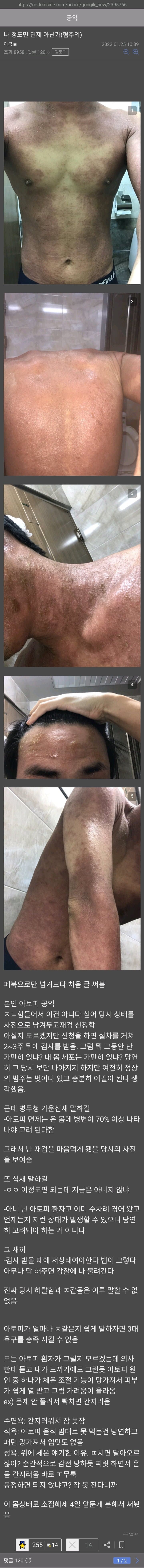 혐주의)나 정도면 면제 아닌가