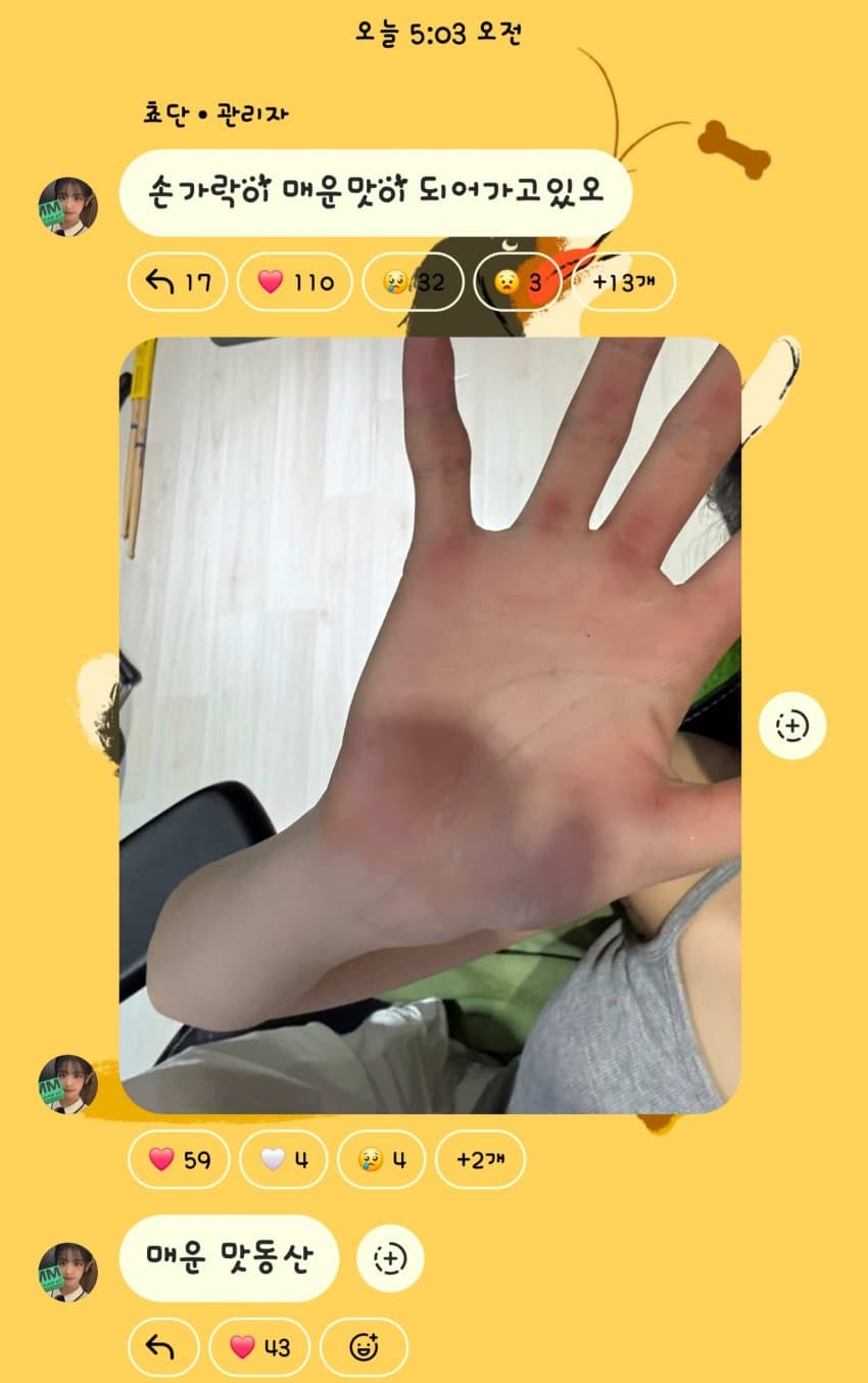 QWER 현재 쵸단에 손바닥