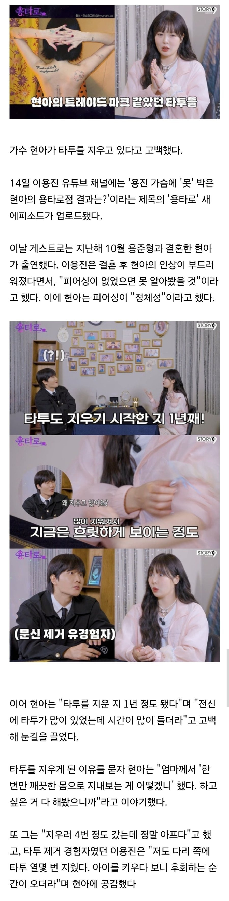 온몸을 문신으로 도배했던 현아가 제거 시술 받는 이유