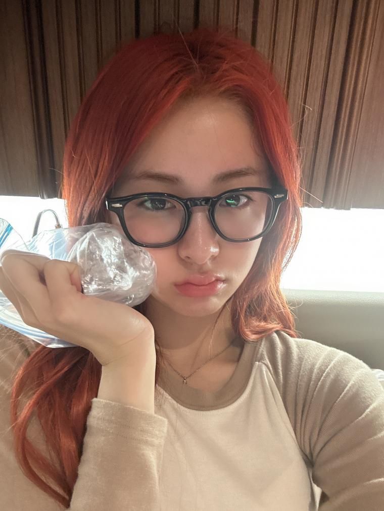 르세라핌 허윤진