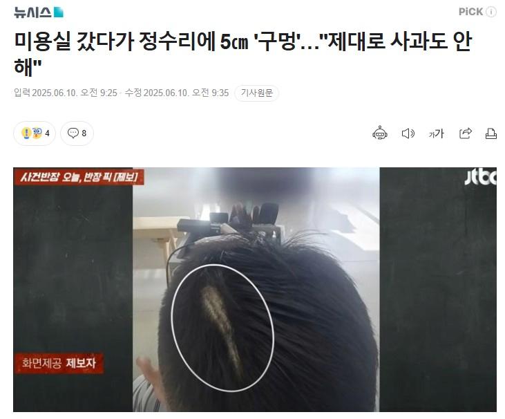 미용실 갔다가 정수리에 5cm '구멍'..."제대로 사과도 안 해"