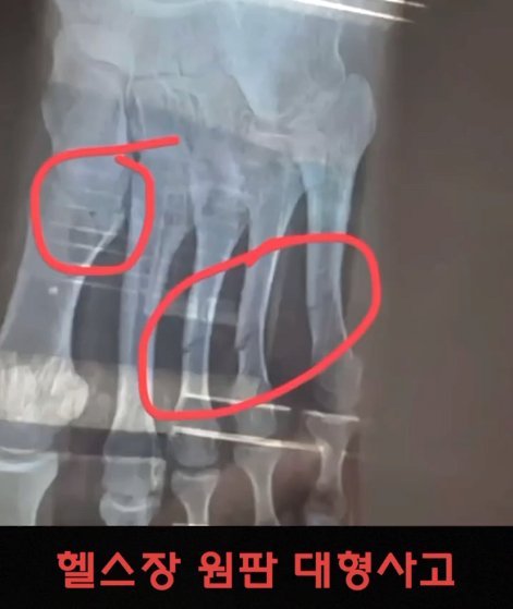 (약혐) 헬스장에서 발생하는 대형 사고