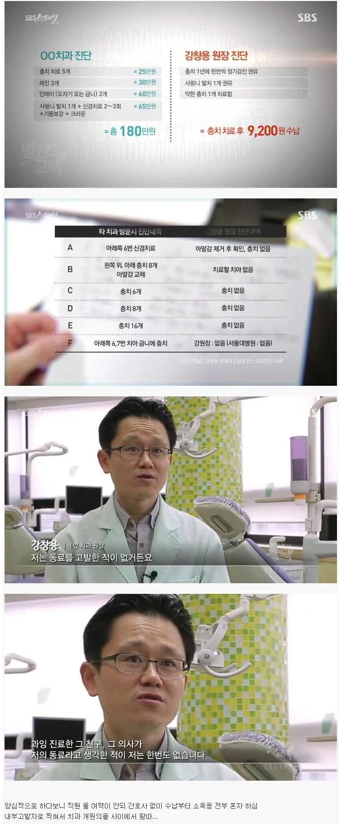 치과 과잉 치료 무섭네