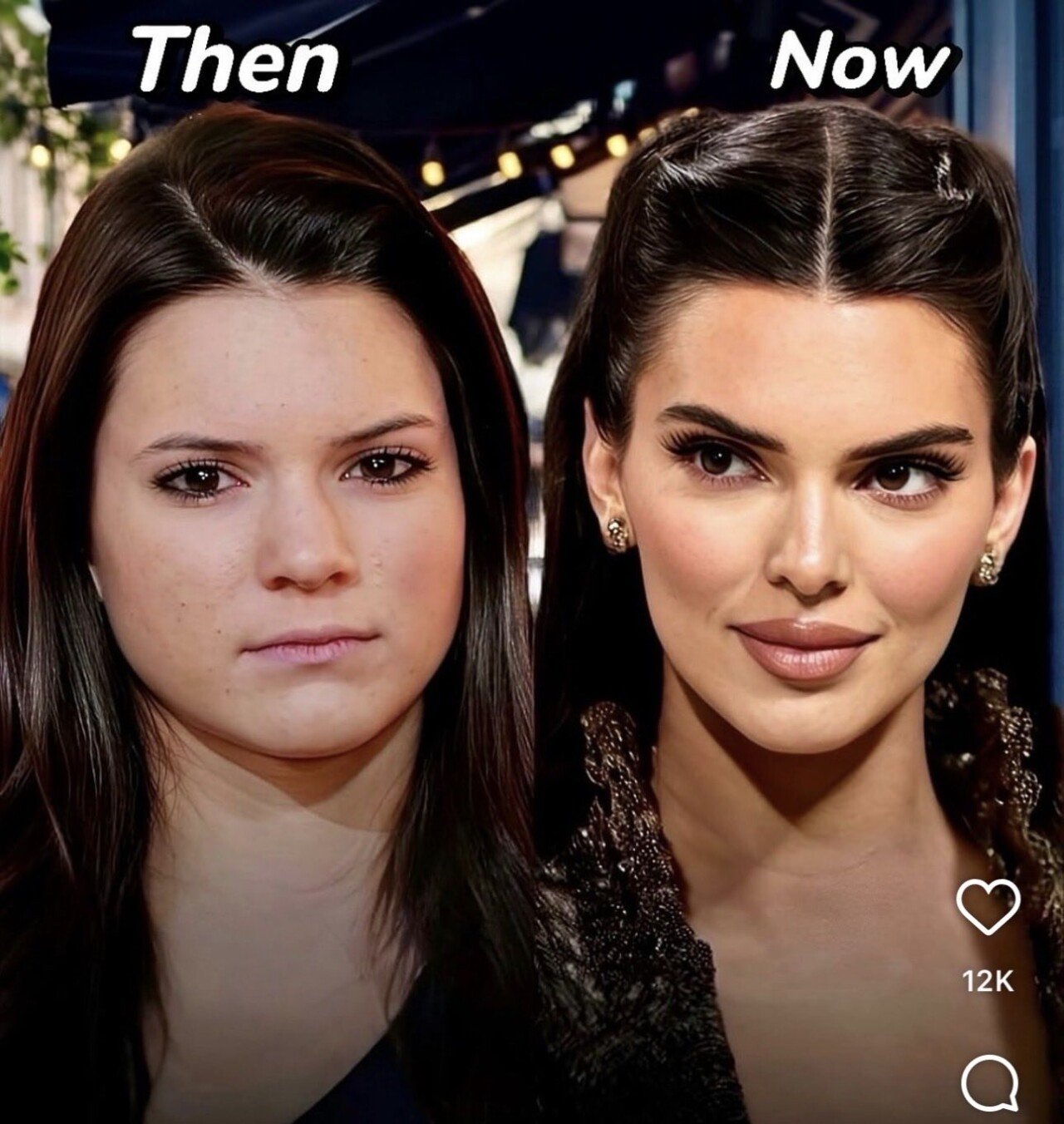 켄달 제너 성형 전 후 비교