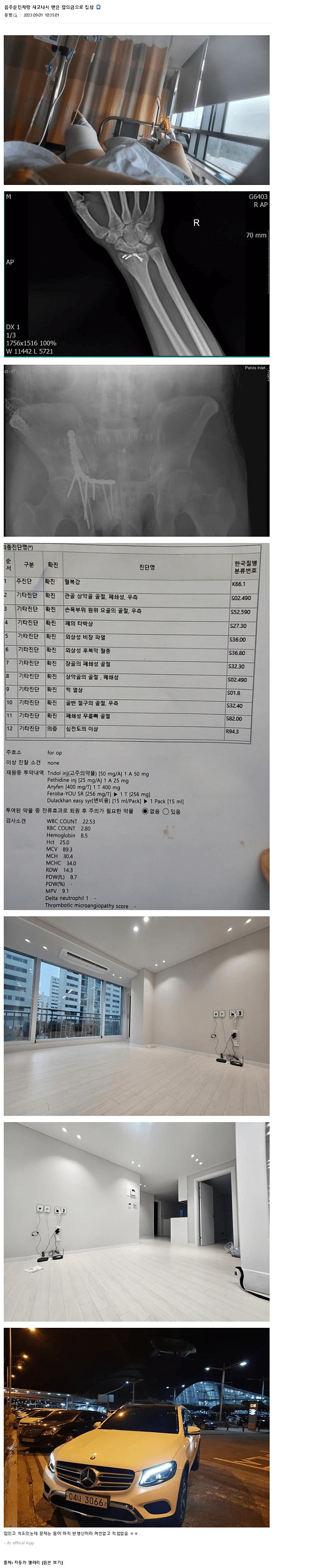 합의금으로 집, 벤츠 구매한 디씨인