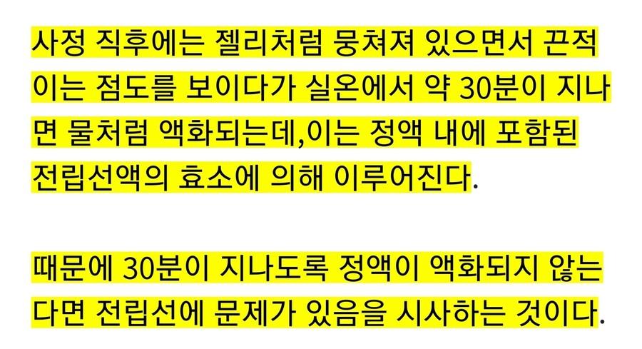 ㅅㅅ후에 정액이 흘러내리는 이유