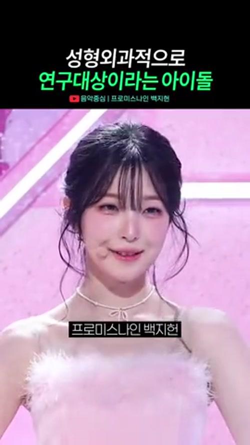 성형외과적으로 연구대상이라는 백지헌(프로미스나인)